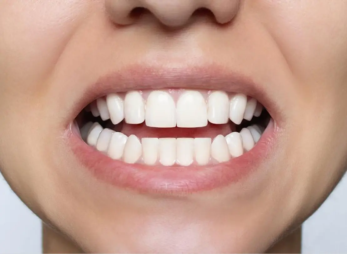 Rehabilitation after img