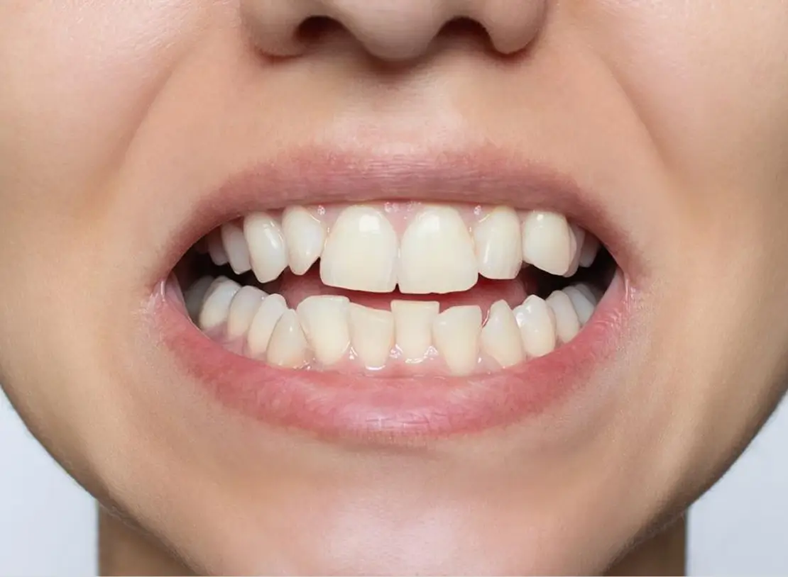 Rehabilitation before img