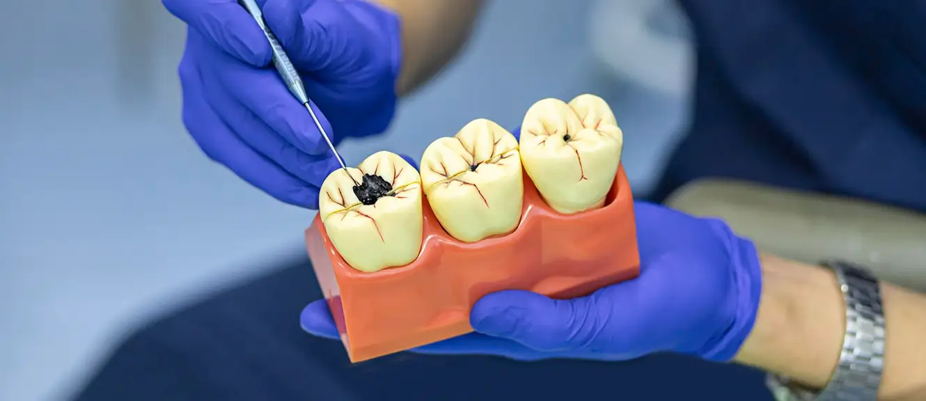 Bone Grafting