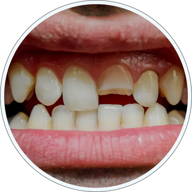 Dental problems mobile