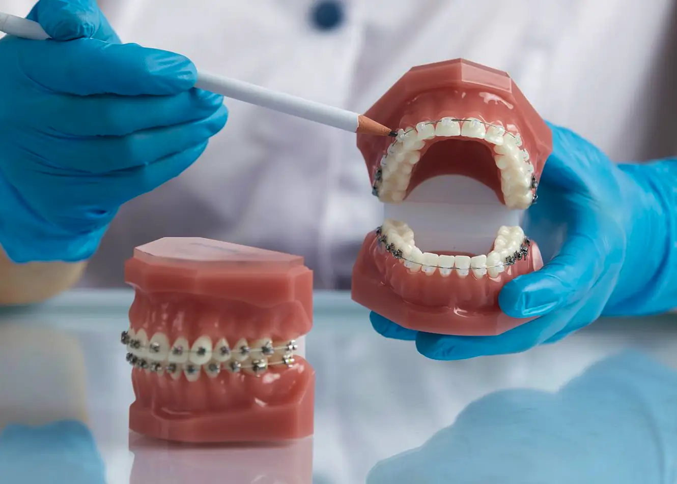 Full mouth rehabilitation