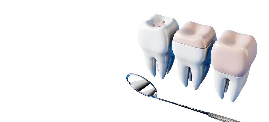 Restorative Dentistry Banner