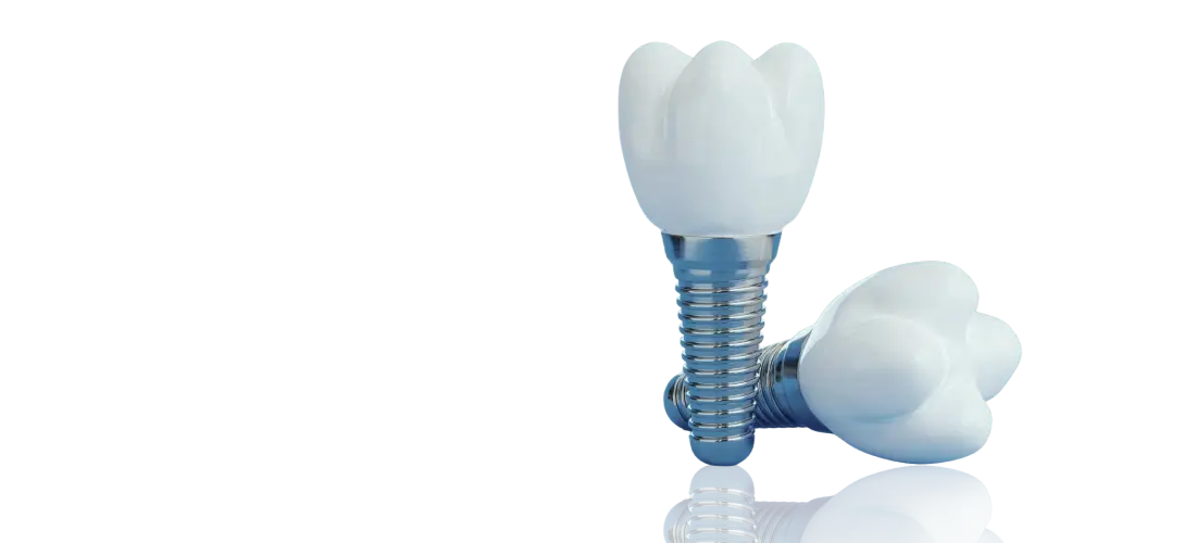 Single Tooth Replacement Banner
