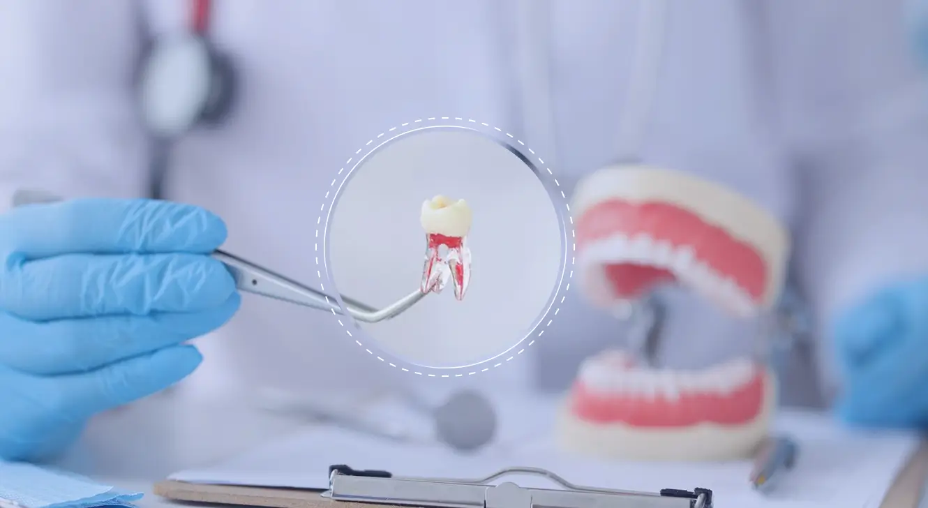 Single Tooth Replacement